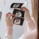USG w ciąży bez tajemnic: jak czytać skróty i liczby na wydruku badania?